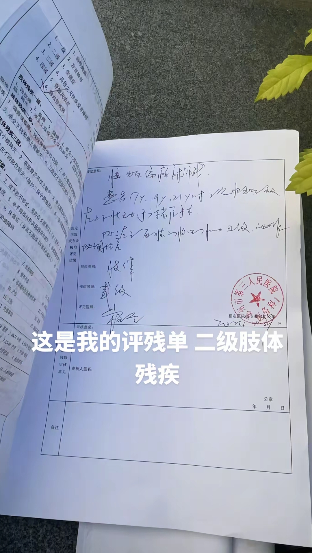 yid, 管是畸形的